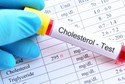 Cholesterol-blood-test