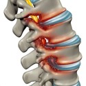 Spinal Pain 12